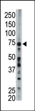 FACL6 antibody used in western blot to detect FACL6 in mouse liver tissue lysate