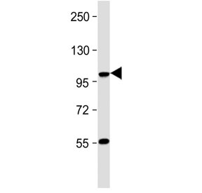 Western blot testing of mouse skeletal muscle tissue with LGR5 antibody. Predicted molecular weight ~100 kDa.