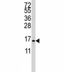 Western blot analysis of S100A11 antibody and CEM lysate. Predicted molecular weight 12~15 kDa.