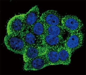 Confocal immunofluorescent analysis of phospho-TERT antibody with HeLa cells followed by Alexa Fluor 488-conjugated goat anti-rabbit lgG (green). Actin filaments have been labeled with Alexa Fluor 555 Phalloidin (red). DAPI was used as a nuclear counterstain (blue).