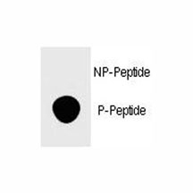 Dot blot analysis of phospho-FOXP3 antibody. 50ng of phos-peptide or nonphos-peptide per dot were spotted.