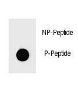 Dot blot analysis of phospho-PARP1 antibody. 50ng of phos-peptide or nonphos-peptide per dot were spotted.