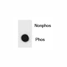 Dot blot analysis of phospho-IKK beta antibody. 50ng of phos-peptide or nonphos-peptide per dot were spotted.