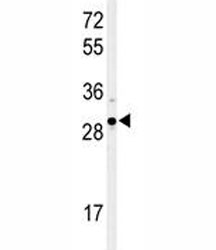 Western blot analysis of XBP1 antibody and Ramos lysate. Predicted molecular weight: ~29 kDa (isoform 1) and ~40 kDa (isoform 2).