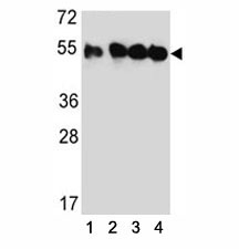 Western blot analysis of TUBB2C antibody and (1) HeLa, (2) MDA-MB435, (3) MDA-MB231, and (4) HepG2 lysate.