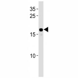HMGA2 antibody western blot analysis in HepG2 lysate. Predicted molecular weight ~12kDa but routinely observed at ~18kDa.