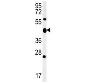 ACSF3 antibody western blot analysis in mouse heart tissue lysate (15ug/lane).