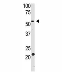 Western blot testing of BACE2 antibody and HL-60 cell lysate