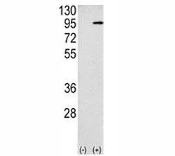 Western blot analysis APP antibody and 293 cell lysate (2 ug/lane) either nontransfected (Lane 1) or transiently transfected with the APP gene (2). Predicted molecular weight 79~120 kDa depending on glycosylation level.