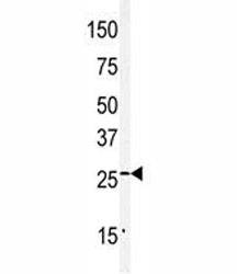 Western blot analysis of Claudin 2 antibody and mouse kidney tissue lysate.