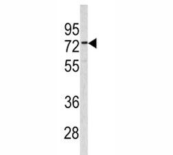 Western blot analysis of CEA antibody and 293 lysate. Expected molecular weight: 80~200 kDa depending on glycosylation level.