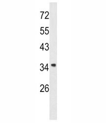 Western blot analysis of Annexin A1 antibody and A2058 lysate. Predicted molecular weight ~36 kDa.