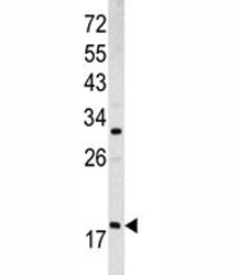 Western blot analysis of ARF3 antibody and MCF-7 lysate