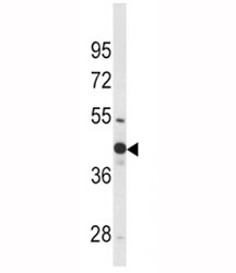 Western blot analysis of WNT4 antibody and mouse bladder tissue lysate.