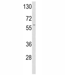 Western blot analysis of tPA antibody and A2058 lysate.