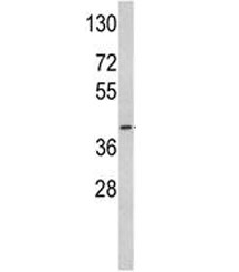 Western blot analysis of ACADM antibody and mouse heart tissue lysate. Predicted molecular weight: ~46kDa.