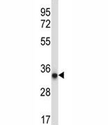 AMPK beta 2 antibody western blot analysis in A375 lysate. Expected molecular weight ~30 kDa.