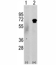Western blot analysis of CAMKK2 antibody and 293 cell lysate either nontransfected (c) or transiently transfected with the CAMKK2 gene (2). Predicted molecular weight 60-65 kDa.