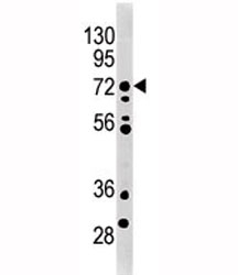 MELK antibody used in western blot to detect MRLK/MELK in mouse brain tissue lysate. Predicted molecular weight ~ 73 kDa.