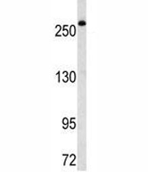 Western blot analysis of FASN antibody in Ramos lysate. Predicted molecular weight ~ 270 kDa.