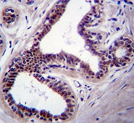 JNK1 antibody immunohsitochemistry analysis in formalin fixed and paraffin embedded human breast tissue.
