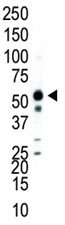Western blot analysis of JNK2 antibody and Jurkat cell lysate.