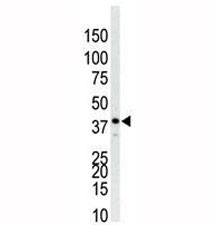p38 antibody used in western blot to detect p38 in Jurkat cell lysate