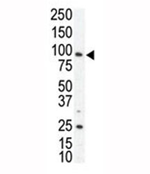 Western blot analysis of AXL antibody and SKBR3 cell lysate. Predicted molecular weight is 104 kDa unglycosylated, 120-140 kDa with glycosylation