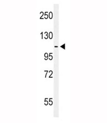 Western blot analysis of EphA2 antibody and MCF-7 lysate. Expected molecular weight: 108~130 kDa.