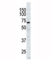 Western blot analysis of EphA3 antibody and CHO cell lysate. Predicted molecular weight: 110/61 kDa (isoforms 1/2).