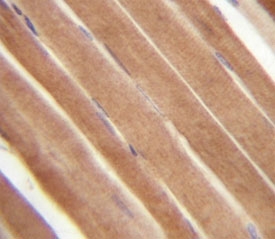 EphB2 antibody analysis in formalin fixed and paraffin embedded human skeletal muscle