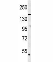 Western blot analysis of KDR antibody and mouse lung tissue lysate. Predicted molecular weight: ~152 (immature), 180-200 kDa (intermediate) and 220-230 kDa (mature).