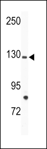 Western blot analysis of TIE1 antibody and mouse bladder tissue lysate.
