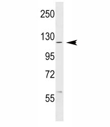 ABL1 antibody western blot analysis in MCF-7 lysate. Predicted molecular weight ~120-150 kDa.