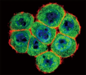 Confocal immunofluorescent analysis of SMAD4 antibody with HeLa cells followed by Alexa Fluor 488-conjugated goat anti-rabbit lgG (green). Actin filaments have been labeled with Alexa Fluor 555 Phalloidin (red). DAPI was used as a nuclear counterstain (blue).