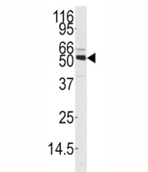 Western blot analysis of CAMKK1 antibody and mouse thymus tissue lysate. Predicted molecular weight 55-60 kDa.