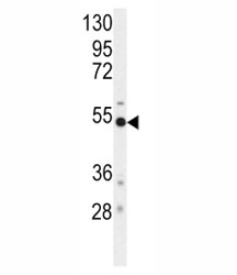 Western blot analysis of BACE antibody and mouse cerebellum tissue lysate.