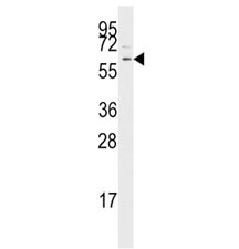 Western blot analysis of TGF Beta Receptor antibody and Jurkat lysate. Predicted molecular weight: ~55kDa.
