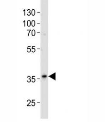 Western blot analysis of lysate from A375 cell line using anti-GAPDH antibody diluted at 1:500. Predicted molecular weight ~36kDa.