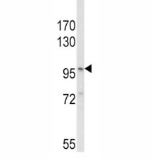 Western blot analysis of NLRP3 antibody and MDA-MB231 lysate. Predicted molecular weight ~118kDa.