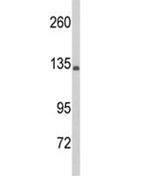 Western blot analysis of C5 antibody and HL-60 lysate