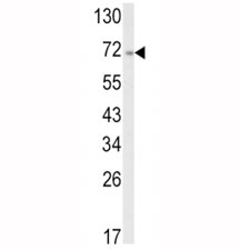 Western blot analysis of ATF6 antibody and A2058 lysate. Predicted molecular weight: 75~90kDa.