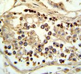 IHC analysis of FFPE human testis tissue stained with ABHD12 antibody
