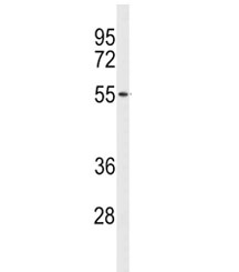 Western blot analysis of ACCN1 antibody and human NCI-H460 lysate. Predicted molecular weight ~58 kDa.