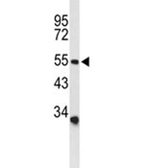 Western blot analysis of ASIC1 antibody and human CEM lysate. Predicted molecular weight ~59 kDa.