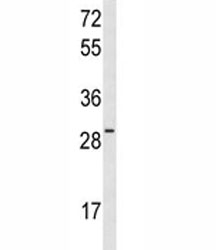 Western blot analysis of HES6 antibody and MCF-7 lysate.