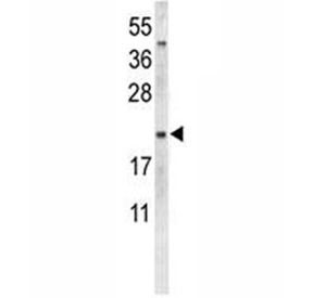 Western blot analysis of Oxytocin-neurophysin 1 (OXT) protein in human MDA-MB-231 cell lysate using the NEU1 antibody. Because the immunogen corresponds to the neurophysin 1 chain of the OXT precursor, a single band is expected near ~10-14 kDa, consistent with the processed neurophysin 1 domain (~10 kDa) and the full prepro-OXT (~13-14 kDa). Under non-reducing or partially processed conditions, higher-migrating bands around ~20 kDa may also appear, reflecting neurophysin dimers or precursor intermediates. The observed size pattern is consistent with literature reports and known maturation of the OXT prohormone into the oxytocin peptide and its carrier neurophysin 1 component.