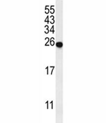 Western blot analysis of SPR antibody and mouse liver tissue lysate. Predicted molecular weight ~28 kDa.