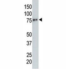 Anti-HA tag antibody testing a tagged recombinant protein.