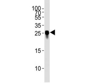 Western blot analysis of tagged protein lysate using GFP antibody at 1:4000.